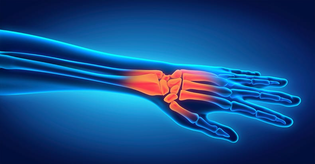 7 Possible Causes of Carpal Tunnel Syndrome - Woodward Chiropractic ...